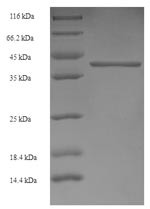 Gamma-aminobutyric acid receptor subunit alpha-4 (GABRA4), partial, human, recombinant