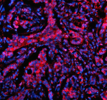 Anti-MTMR3 / Myotubularin-related protein 3
