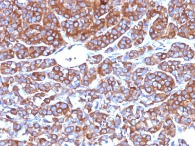 Anti-CD10(CB-CALLA), CF568 conjugate, 0.1mg/mL