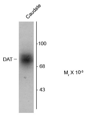 Anti-Dopamine Transporter, C-terminal
