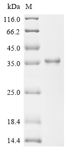 Golgin subfamily A member 2 (Golga2), partial, mouse, recombinant