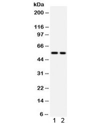 Anti-Cystatin A / CSTA
