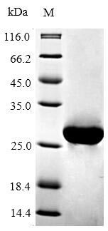 Apoptosis regulator Bcl-2 (Bcl2), partial, mouse, recombinant