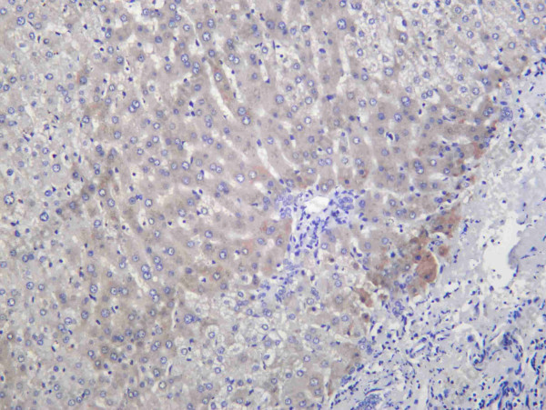 Anti-Recombinant PLOD2, clone C112454