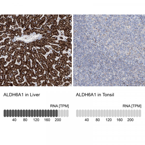 Anti-ALDH6A1