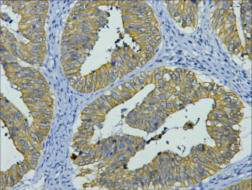 Anti-KRT8 Monoclonal
