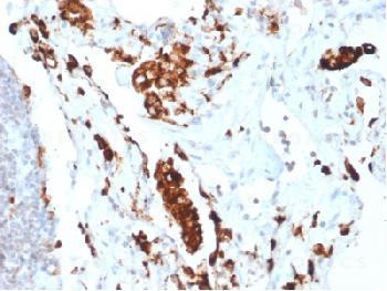 Anti-Napsin A (Lung Adenocarcinoma Marker) Recombinant Rabbit Monoclonal Antibody (clone:NAPSA/1865R