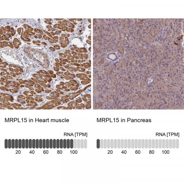 Anti-MRPL15