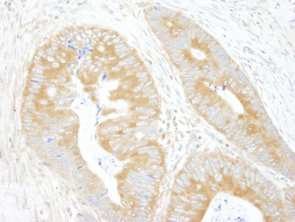 Anti-eIF3A/eIF3S10 (IHC)