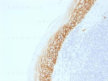 Anti-CD44v9 (Marker of Tumor Metastasis) Recombinant Rabbit Monoclonal Antibody (clone:CD44v9/2344R)