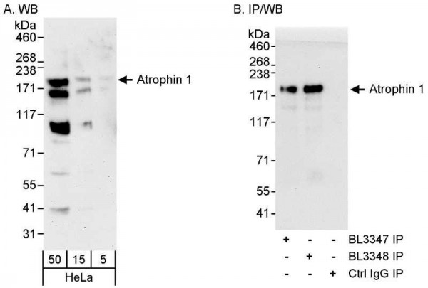 Anti-Atrophin 1