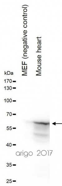 Anti-Desmin, clone SQab1722