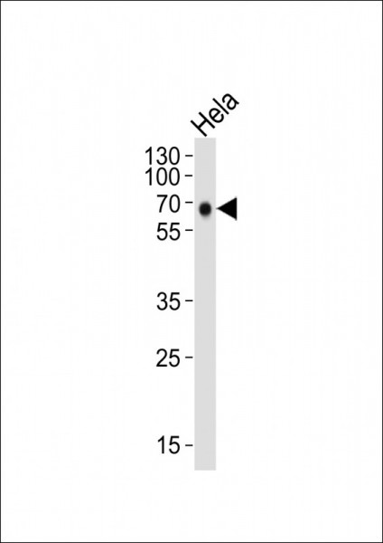 Anti-GPR56, clone 1443CT377.65.29