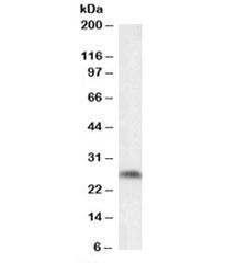 Anti-Ptgds