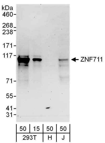 Anti-ZNF711