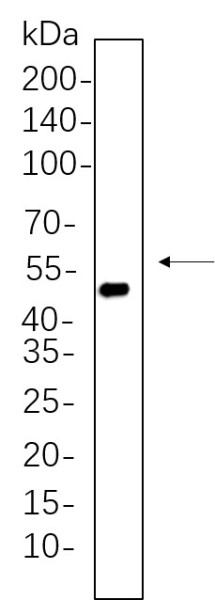 Anti-Recombinant Cytokeratin 20, clone 6C5