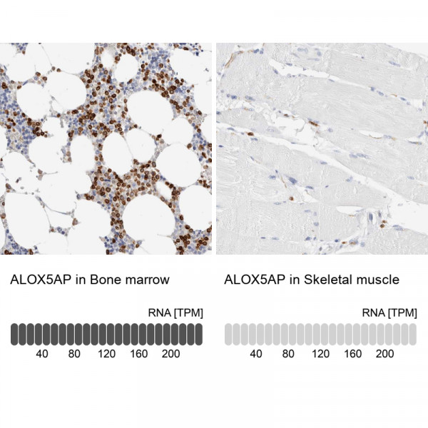 Anti-ALOX5AP