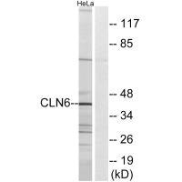 Anti-CLN6
