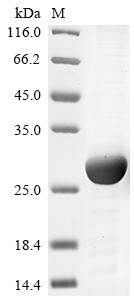Ras-related protein Rab-10 (Rab10), mouse, recombinant
