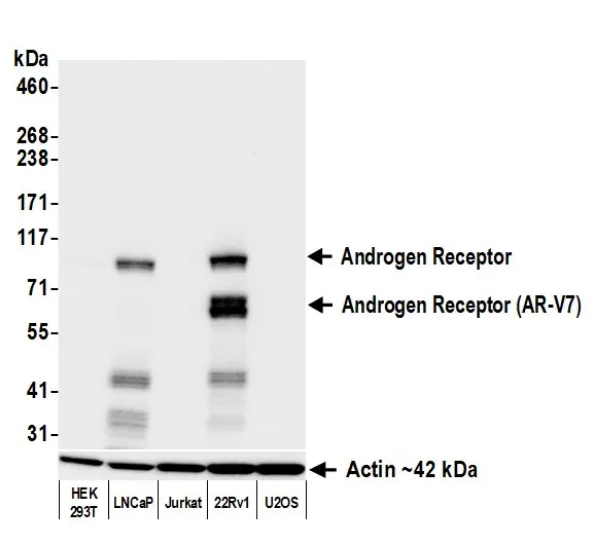 Anti-Androgen Receptor Recombinant Monoclonal