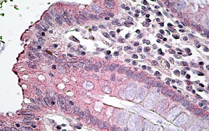 Anti-SLC12A2, Internal