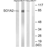 Anti-SLCO1A2