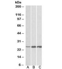 Anti-TNNI2
