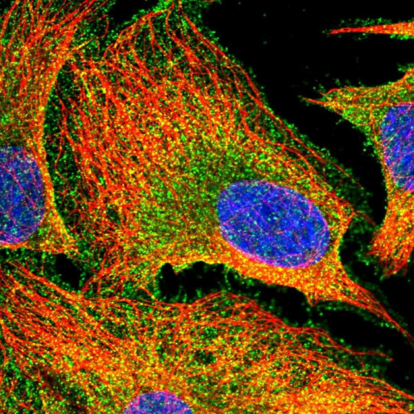 Anti-PACSIN3
