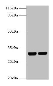 Anti-HLA-DRB1