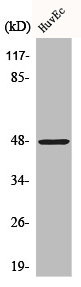Anti-CTSE