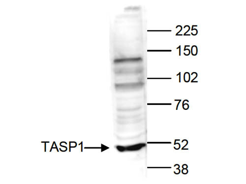 Anti-TASP1