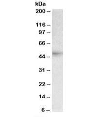 Anti-HCP1
