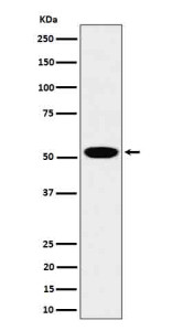 Anti-LAP3 / Leucine aminopeptidase 3, clone 31L65