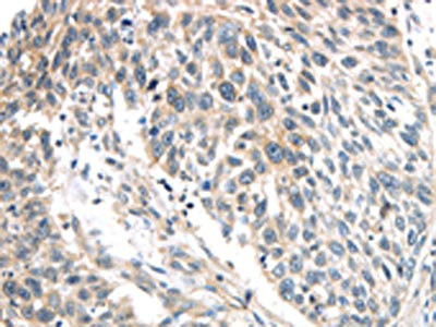 Anti-IQGAP2