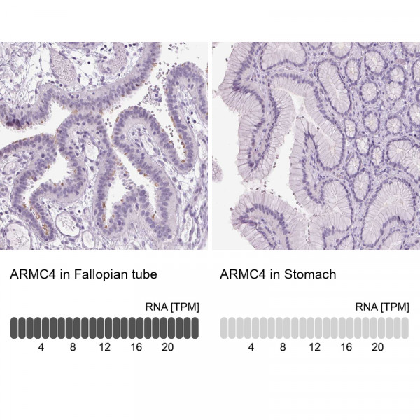 Anti-ARMC4