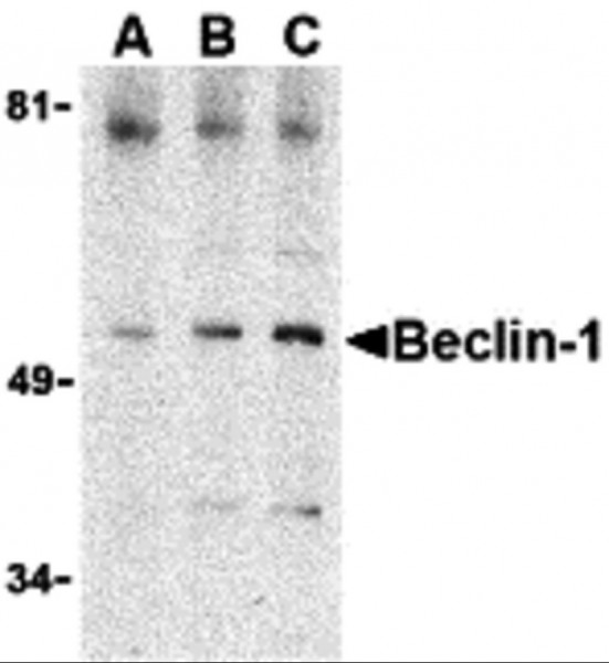 Anti-Beclin-1