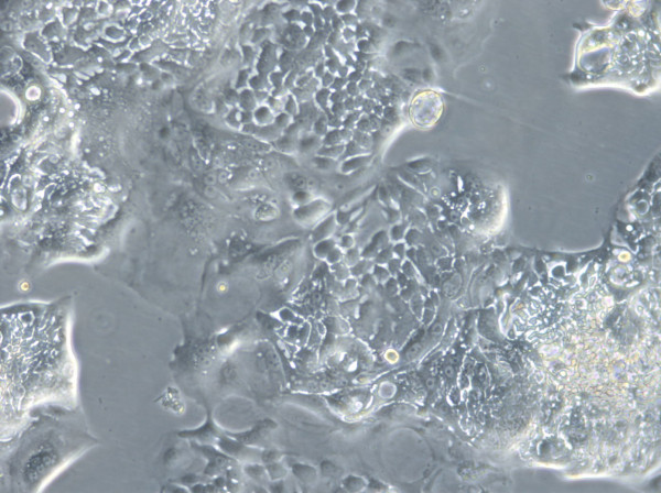HROC43 Cells