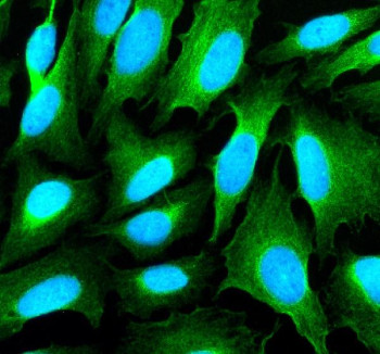 Anti-SHANK1 / SH3 and multiple ankyrin repeat domains protein 1