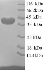 ELAV-like protein 2 (ELAVL2), partial, human, recombinant