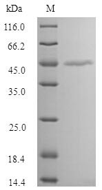 Melanoma-associated antigen 1 (MAGEA1), human, recombinant