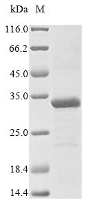 Three-prime repair exonuclease 1 (TREX1), partial, human, recombinant