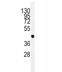 Anti-VEGFC, clone 197CT7.3.4