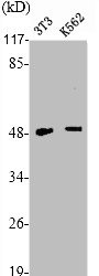 Anti-TNFRSF1B