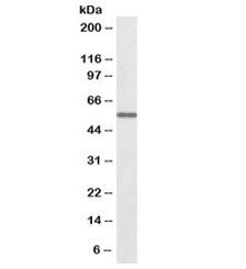Anti-ALDH6A1 Biotin Conjugate
