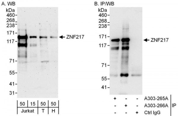 Anti-ZNF217