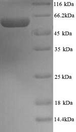 Protein disulfide-isomerase A2 (Pdia2), mouse, recombinant