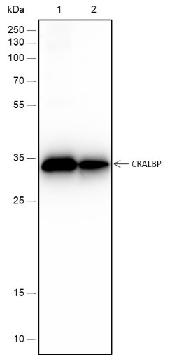 Anti-Recombinant CRALBP, clone A194