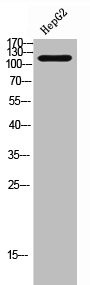 Anti-Phospho-HDAC5/HDAC9 (S259/220)