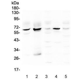 Anti-METTL3 / M6A