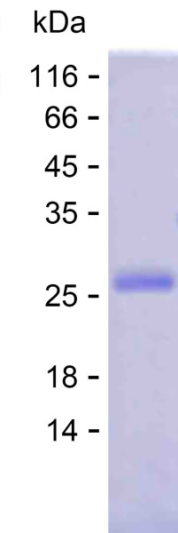 STIM2 (human), recombinant protein